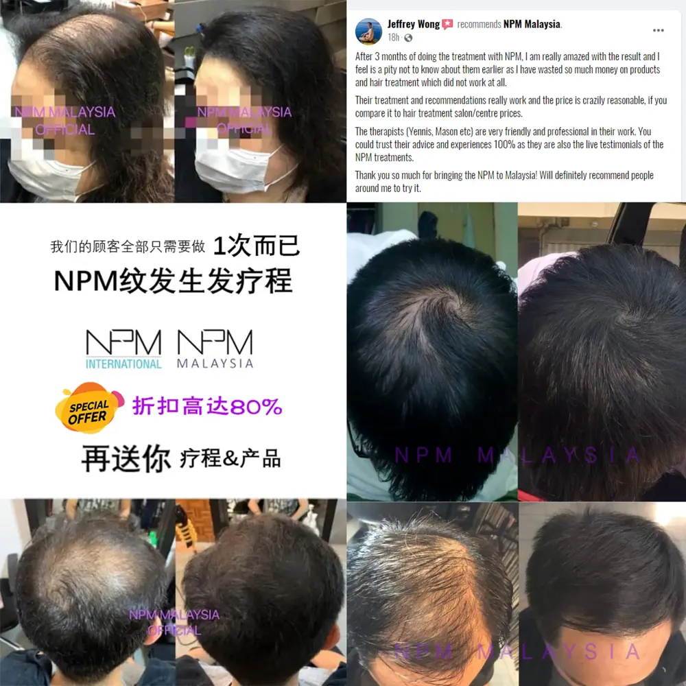 NPM Malaysia